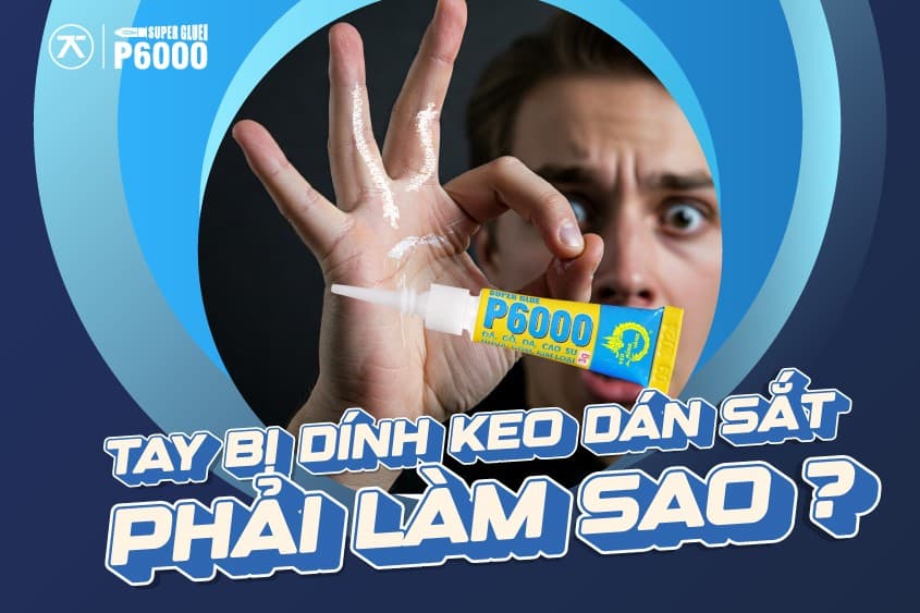 Tay Bị Dính Keo Dán Sắt Phải Làm Sao?